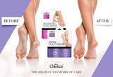 L'Biotica Exfoliating Peel Foot Sock Mask 40ml